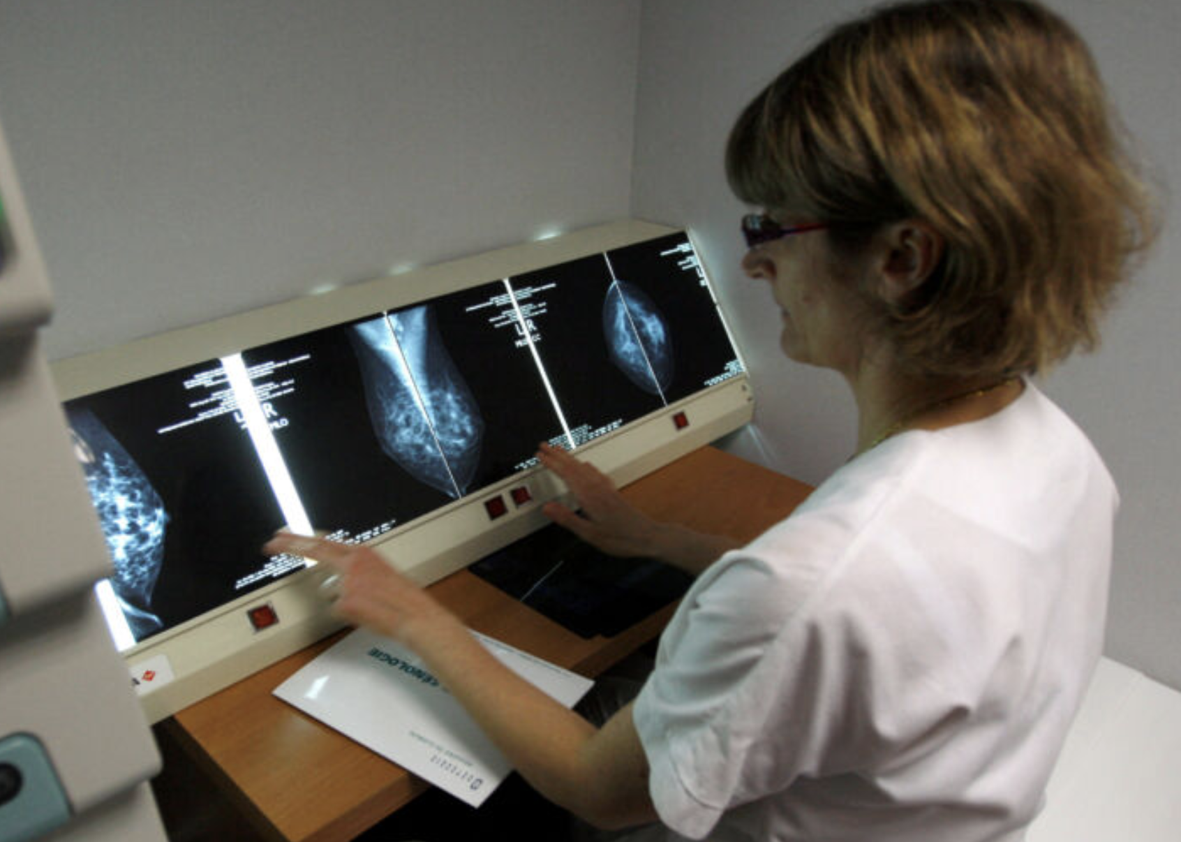 AI Medical Scribes Can ‘Hallucinate’ Patient Data: Report